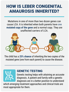 HOW IS LEBER CONGENITAL AMAUROSIS INHERITED? Mutations in one of more than two dozen genes can cause LCA. It is inherited when both parents have one mutated copy of the gene and a normal copy. They are unaffected carriers of LCA. The child has a 25% chance of inheriting the two copies of the mutated gene (one from each parent) to cause the disease. 25% GENETIC TESTING Genetic testing helps with attaining an accurate diagnosis. A patient and family with a genetic diagnosis are in a better position to understand which emerging treatment approaches and clinica trials are most appropriate for them.